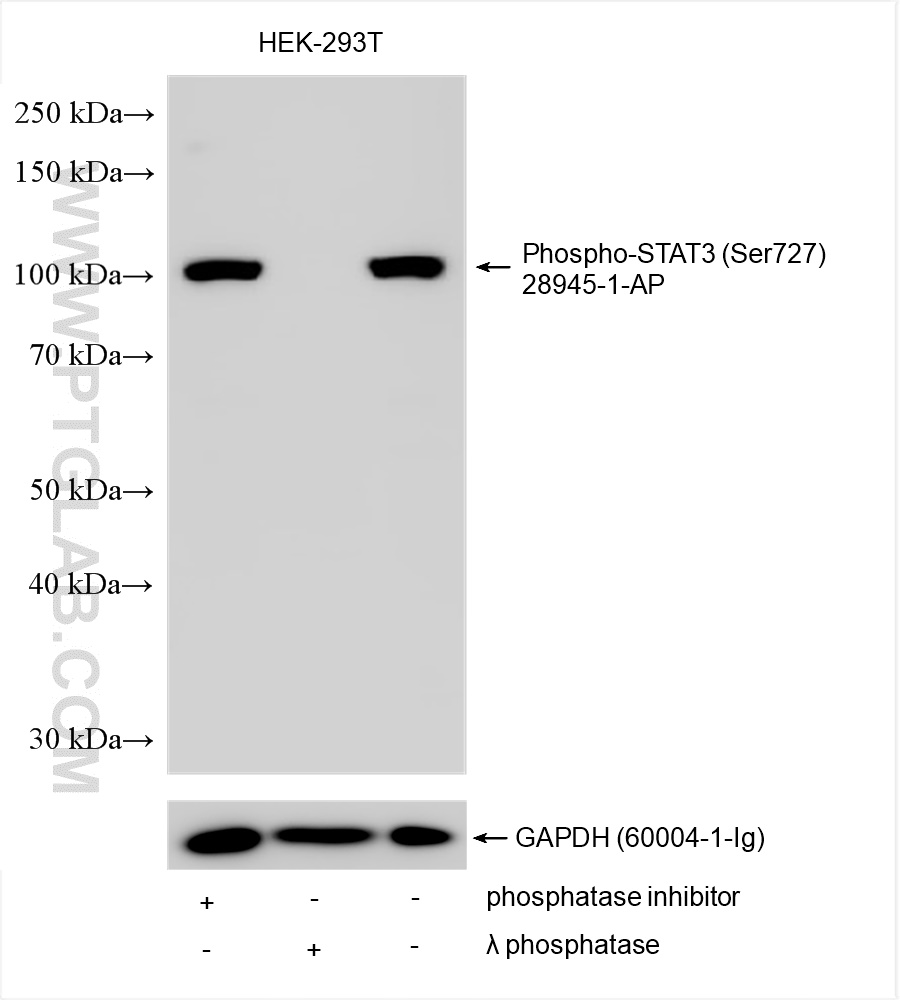Western Blot (WB) analysis of various lysates using Phospho-STAT3 (Ser727) Polyclonal antibody (28945-1-AP)