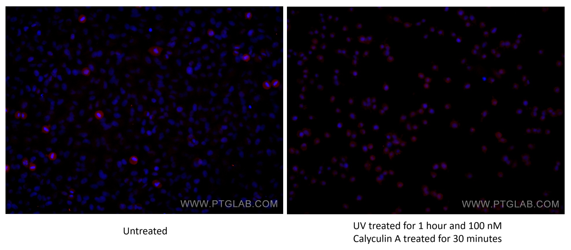 Immunofluorescence (IF) / fluorescent staining of HeLa cells using Phospho-STAT3 (Ser727) Monoclonal antibody (60479-1-Ig)