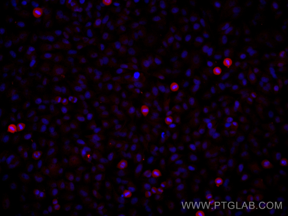 Immunofluorescence (IF) / fluorescent staining of HeLa cells using Phospho-STAT3 (Ser727) Monoclonal antibody (60479-1-Ig)