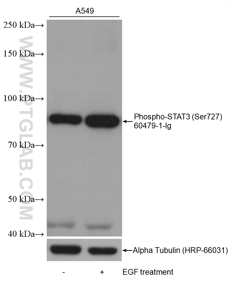 Phospho-STAT3 (Ser727)