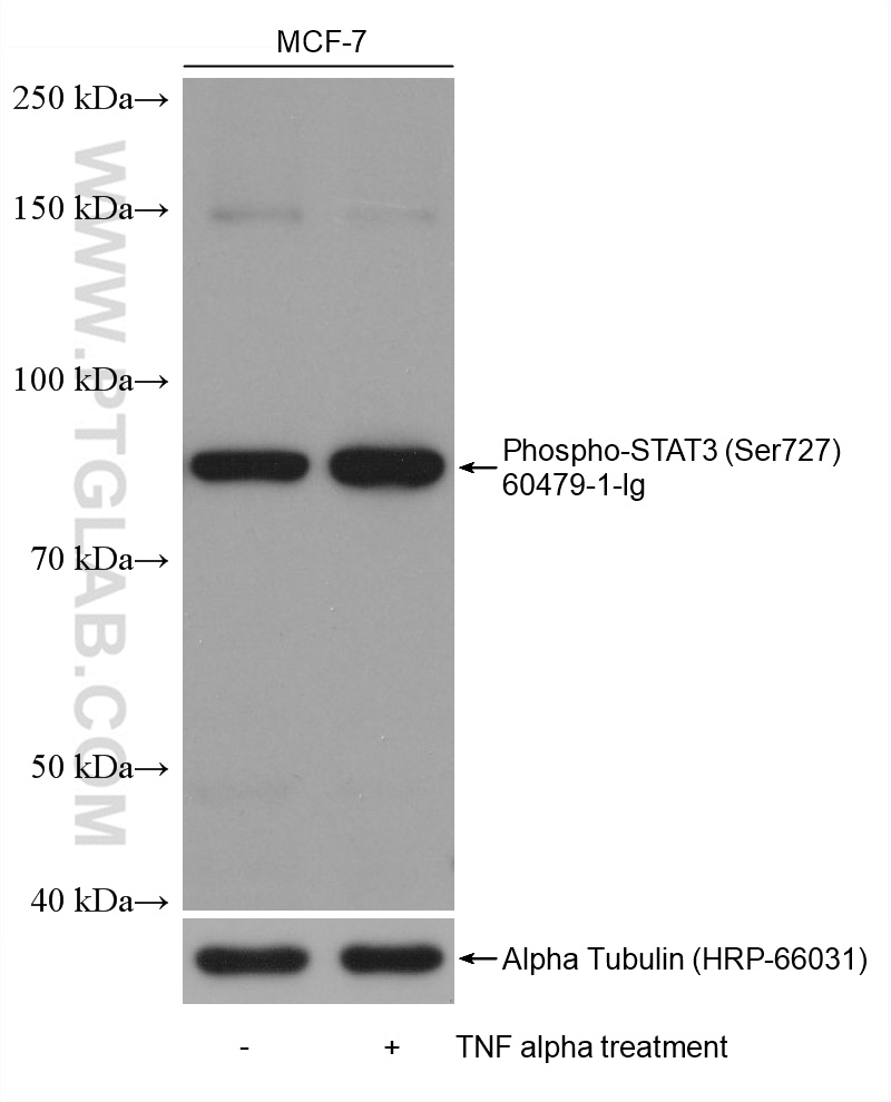 Western Blot (WB) analysis of various lysates using Phospho-STAT3 (Ser727) Monoclonal antibody (60479-1-Ig)