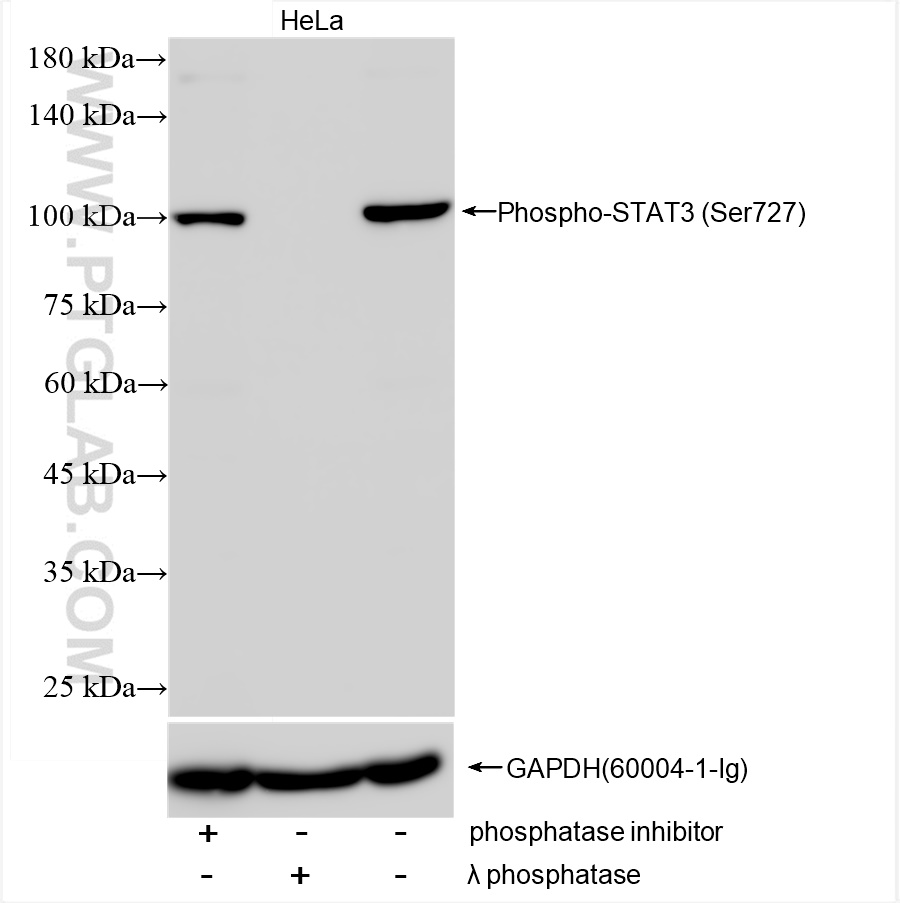 Western Blot (WB) analysis of HeLa cells using Phospho-STAT3 (Ser727) Recombinant antibody (80199-2-RR)