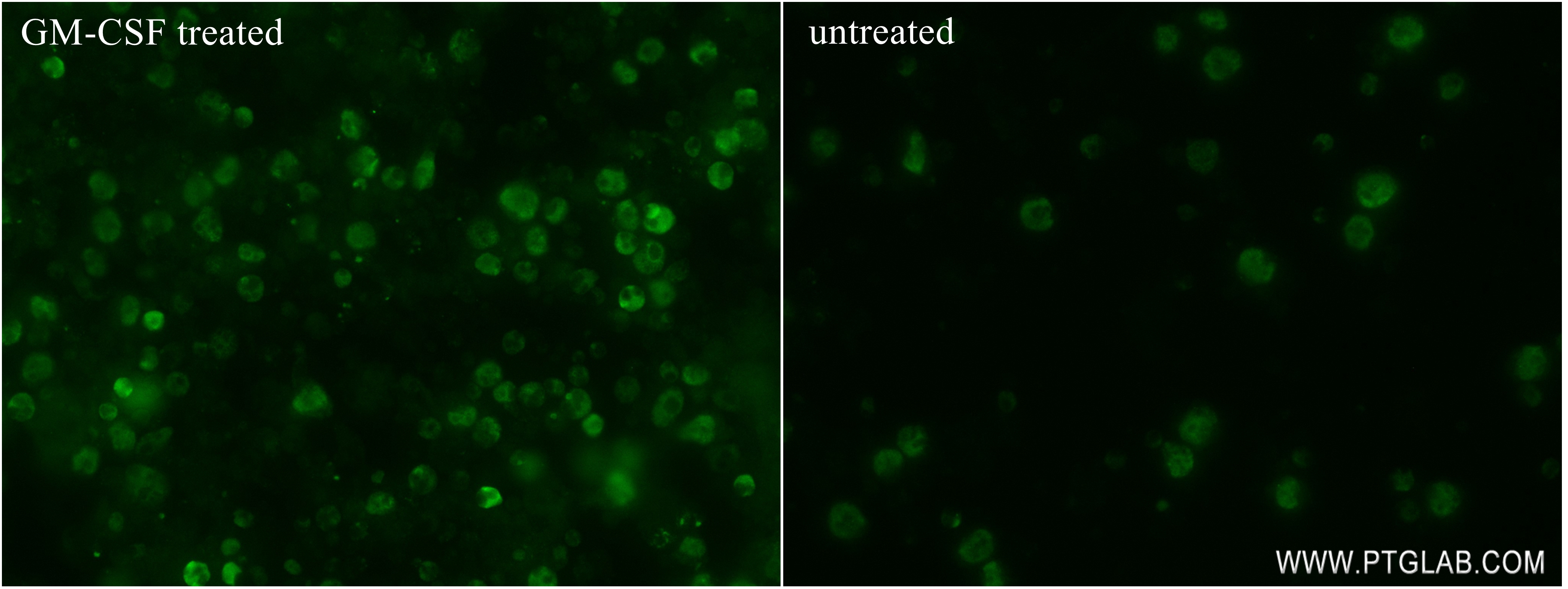 Immunofluorescence (IF) / fluorescent staining of TF-1 cells using Phospho-STAT5A (Ser726) Recombinant antibody (80138-2-RR)