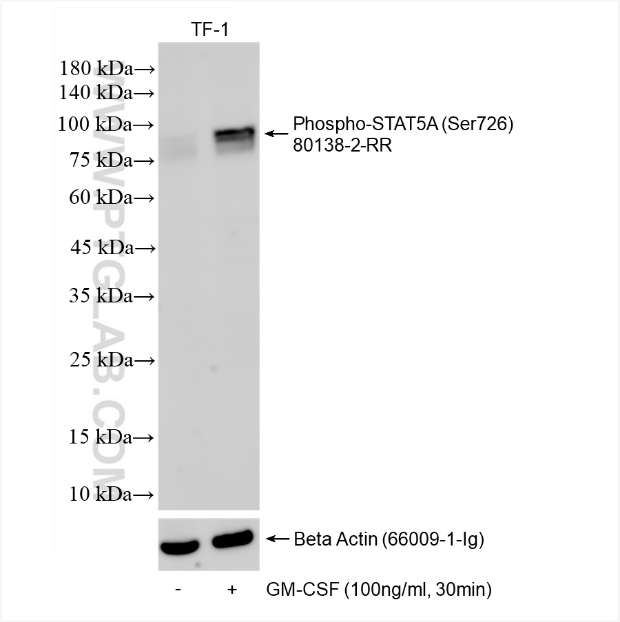 Western Blot (WB) analysis of various lysates using Phospho-STAT5A (Ser726) Recombinant antibody (80138-2-RR)