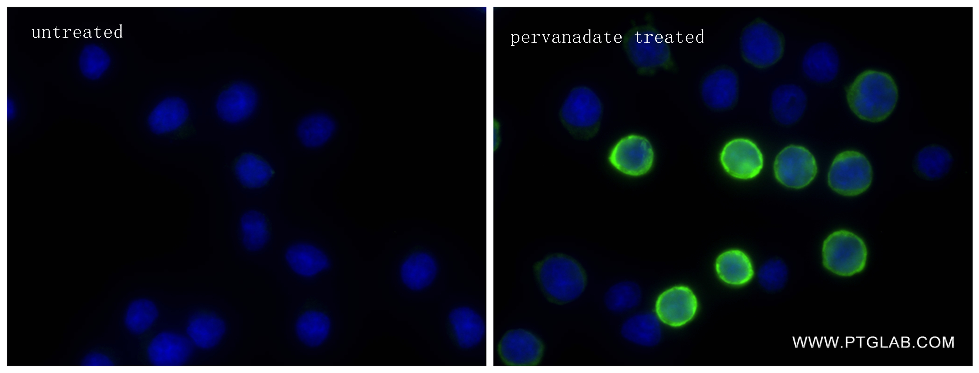 Immunofluorescence (IF) / fluorescent staining of Ramos cells using Phospho-SYK (Tyr323) Recombinant antibody (83331-1-RR)