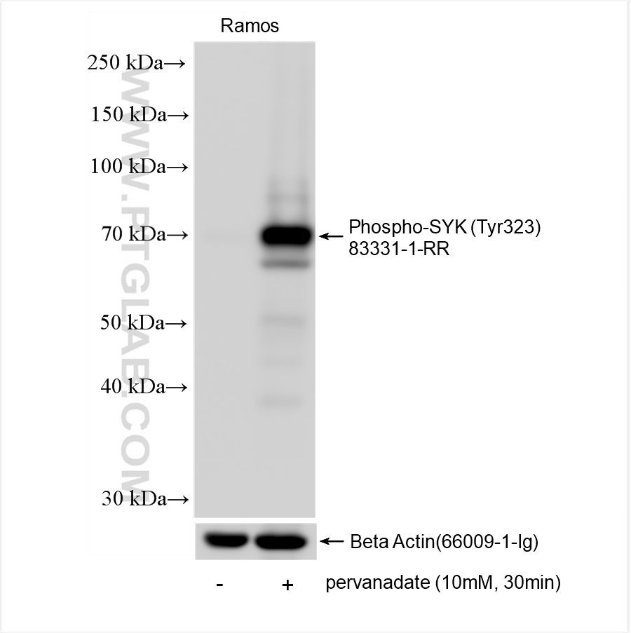 Western Blot (WB) analysis of Ramos cells using Phospho-SYK (Tyr323) Recombinant antibody (83331-1-RR)