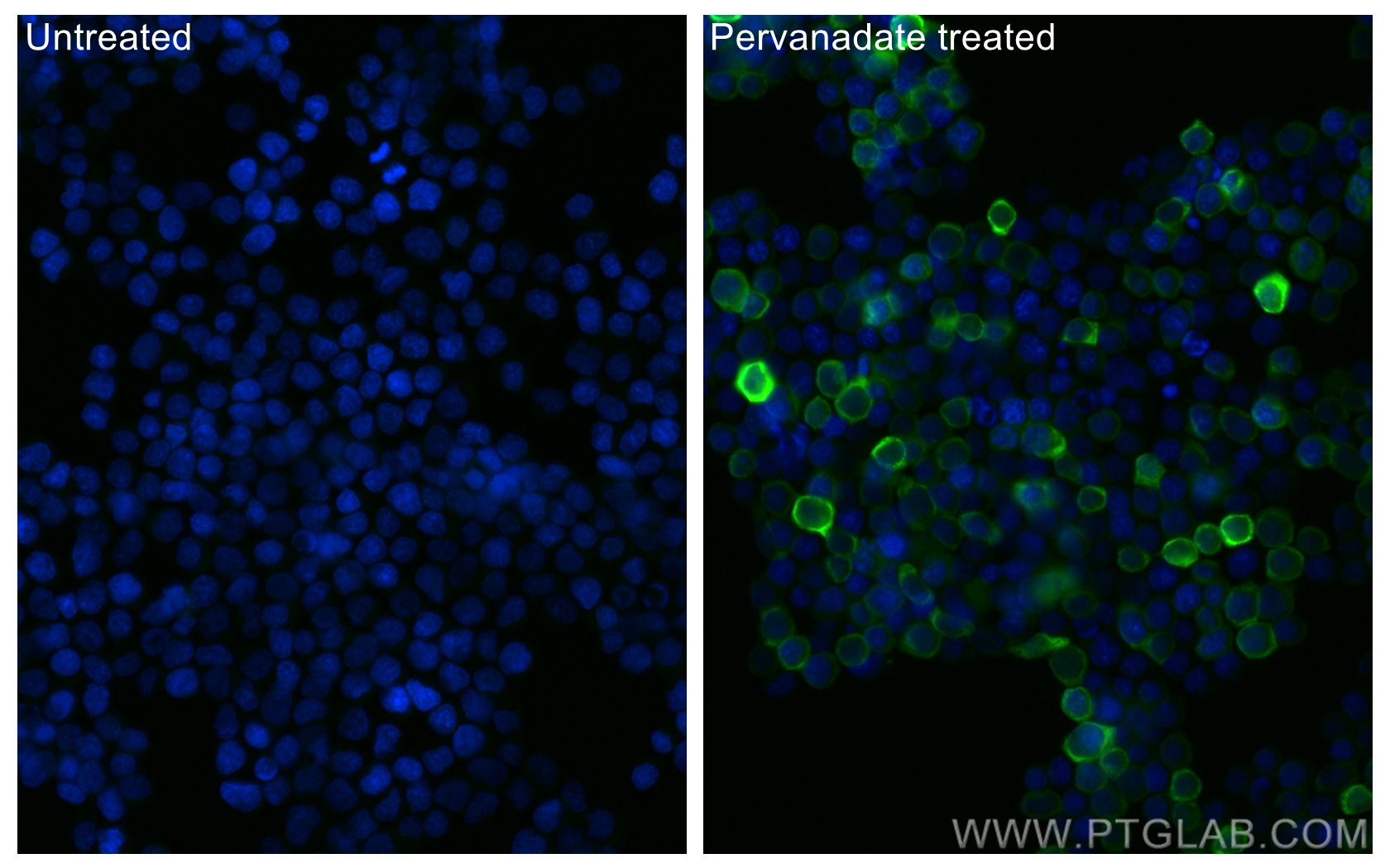 Immunofluorescence (IF) / fluorescent staining of Ramos cells using CoraLite® Plus 488-conjugated Phospho-SYK (Tyr323) (CL488-83331)