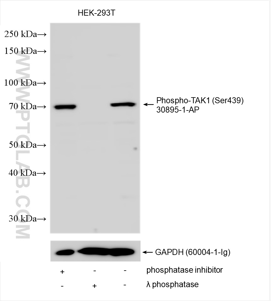 Western Blot (WB) analysis of various lysates using Phospho-TAK1 (Ser439) Polyclonal antibody (30895-1-AP)