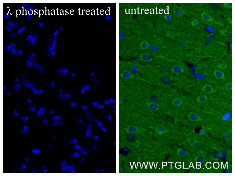 Immunofluorescence (IF) / fluorescent staining of mouse brain tissue using Phospho-TAU (Ser202/Thr205) Recombinant monoclonal (82568-1-RR)