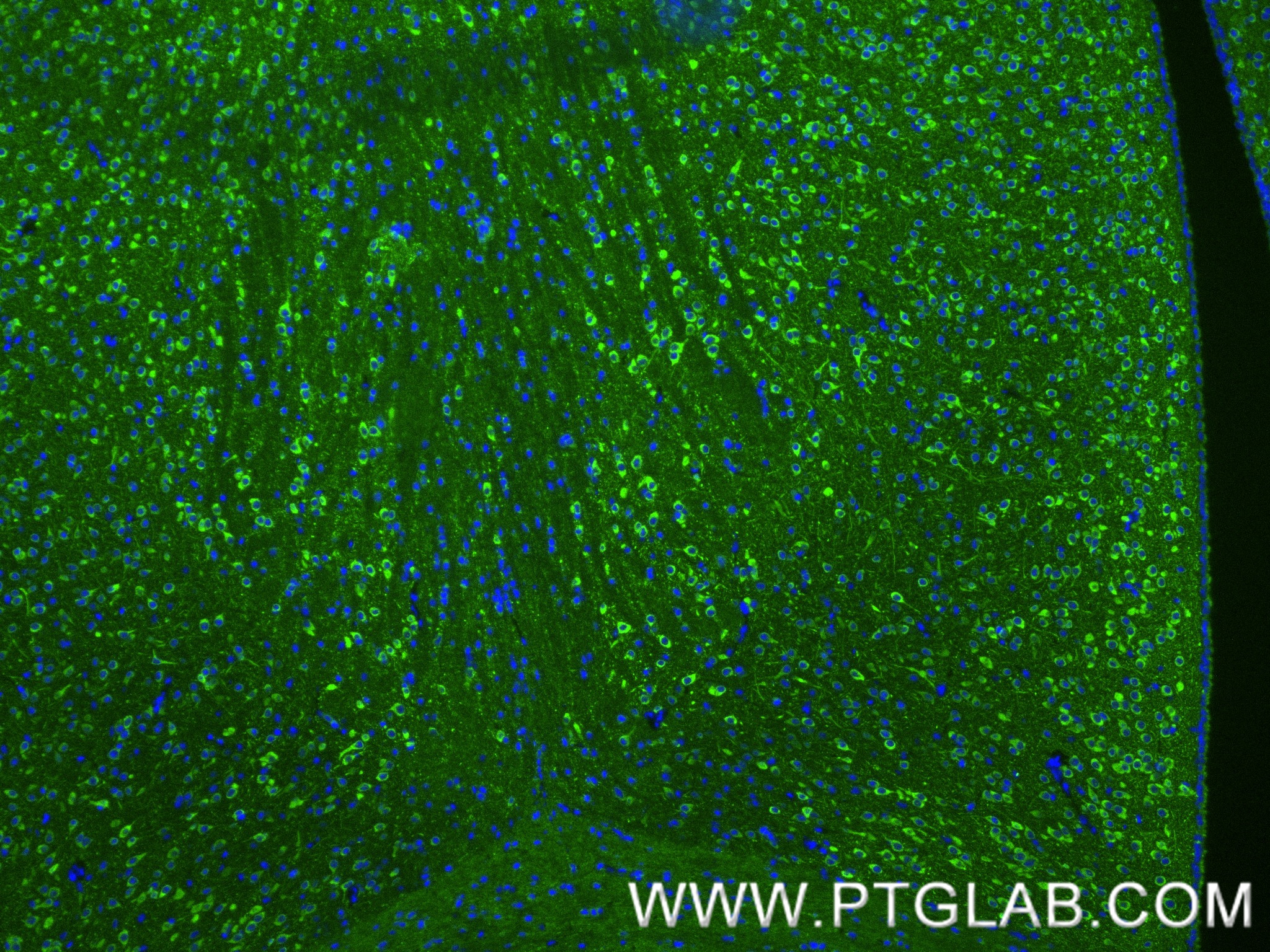 Immunofluorescence (IF) / fluorescent staining of mouse brain tissue using Phospho-TAU (Thr231) Recombinant monoclonal antibo (80101-7-RR)