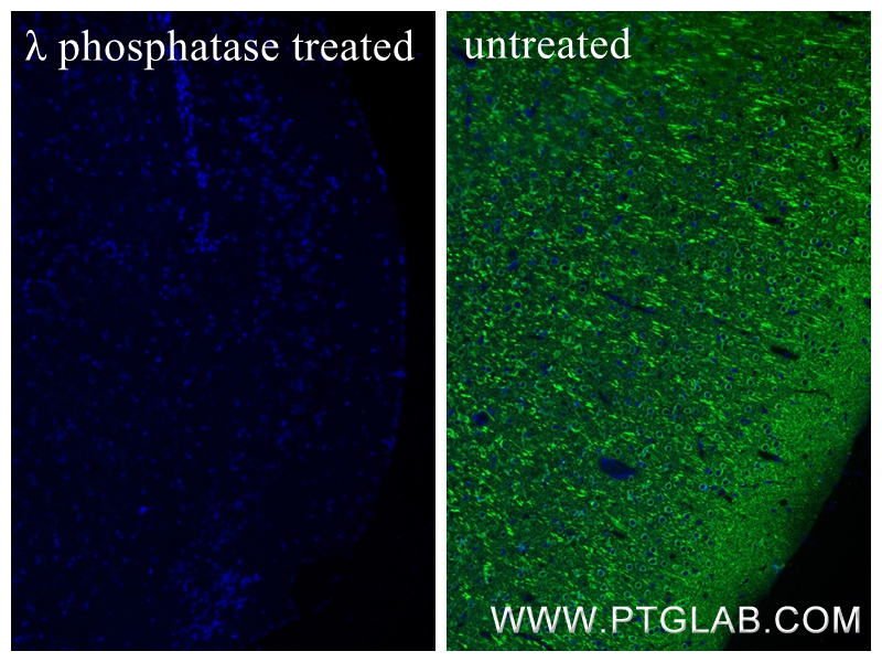 Immunofluorescence (IF) / fluorescent staining of mouse brain tissue using Phospho-TAU (Thr231) Recombinant monoclonal antibo (80101-7-RR)