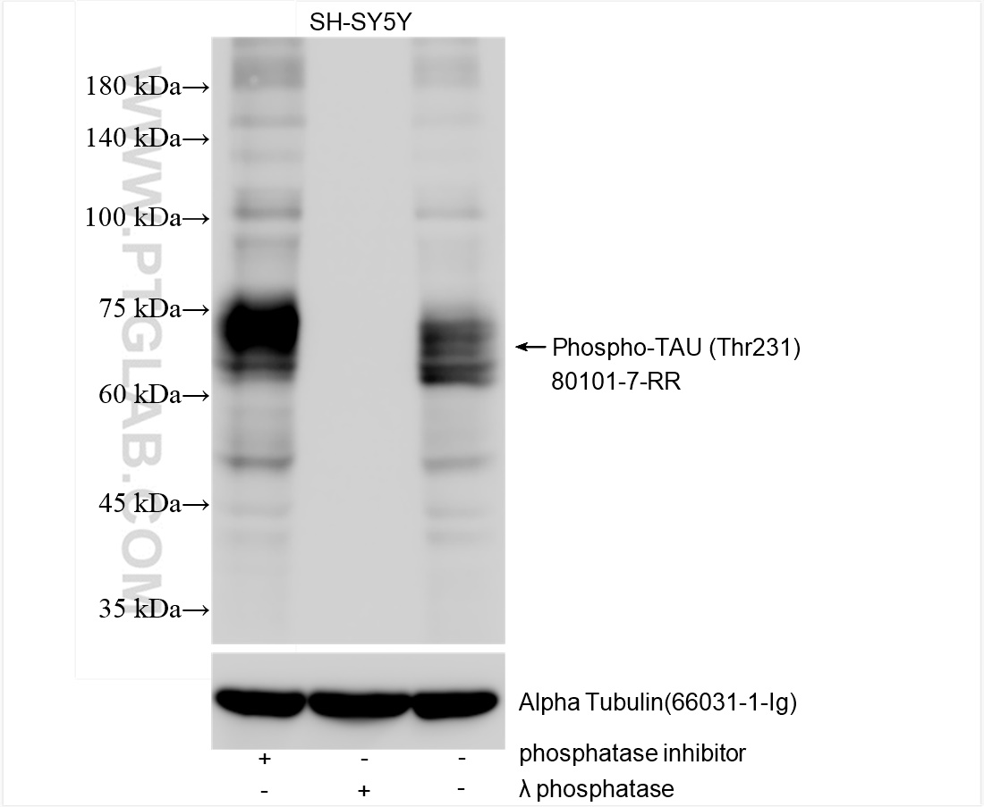 Phospho-TAU (Thr231)