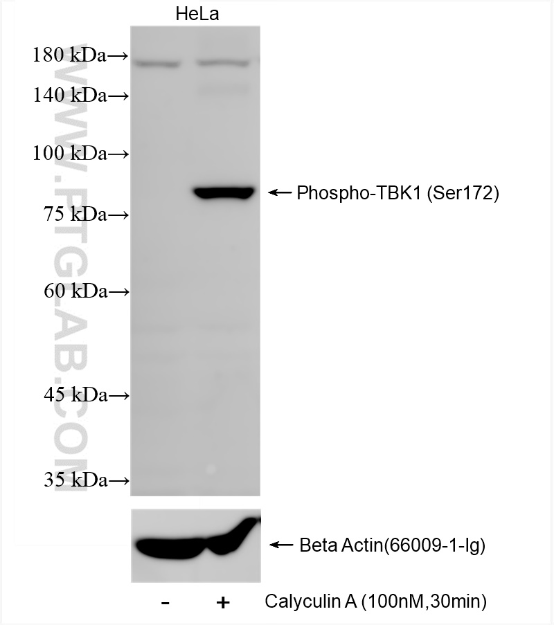 Western Blot (WB) analysis of various lysates using Phospho-TBK1 (Ser172) Recombinant antibody (82382-2-RR)