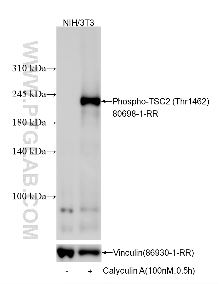 Western Blot (WB) analysis of various lysates using Phospho-TSC2 (Thr1462) Recombinant monoclonal anti (80698-1-RR)