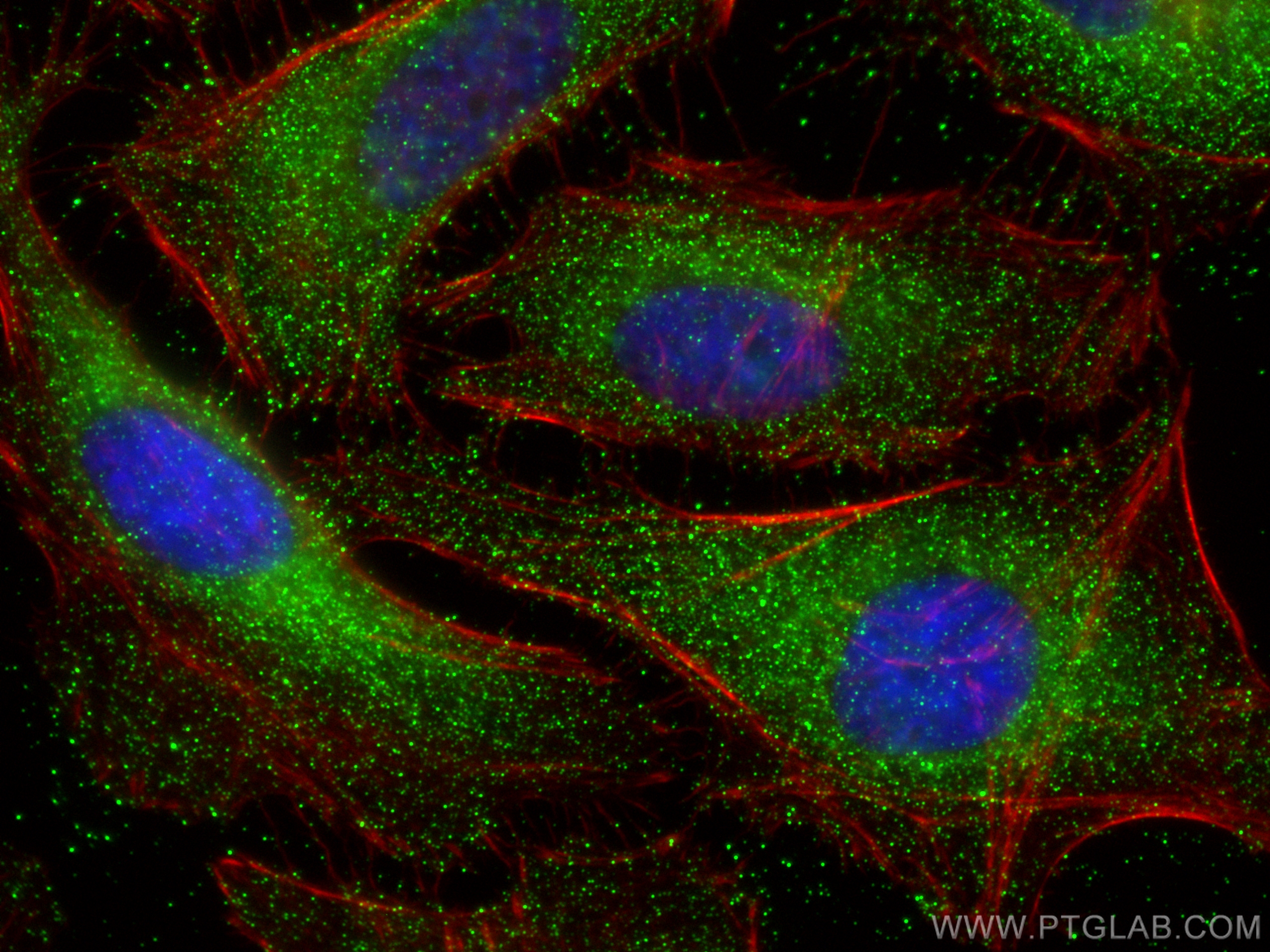 Immunofluorescence (IF) / fluorescent staining of HeLa cells using Phospho-ULK1 (Thr468) Polyclonal antibody (29006-1-AP)