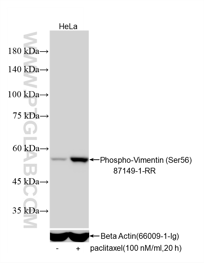 Western Blot (WB) analysis of various lysates using Phospho-Vimentin (Ser56) Recombinant monoclonal an (87149-1-RR)