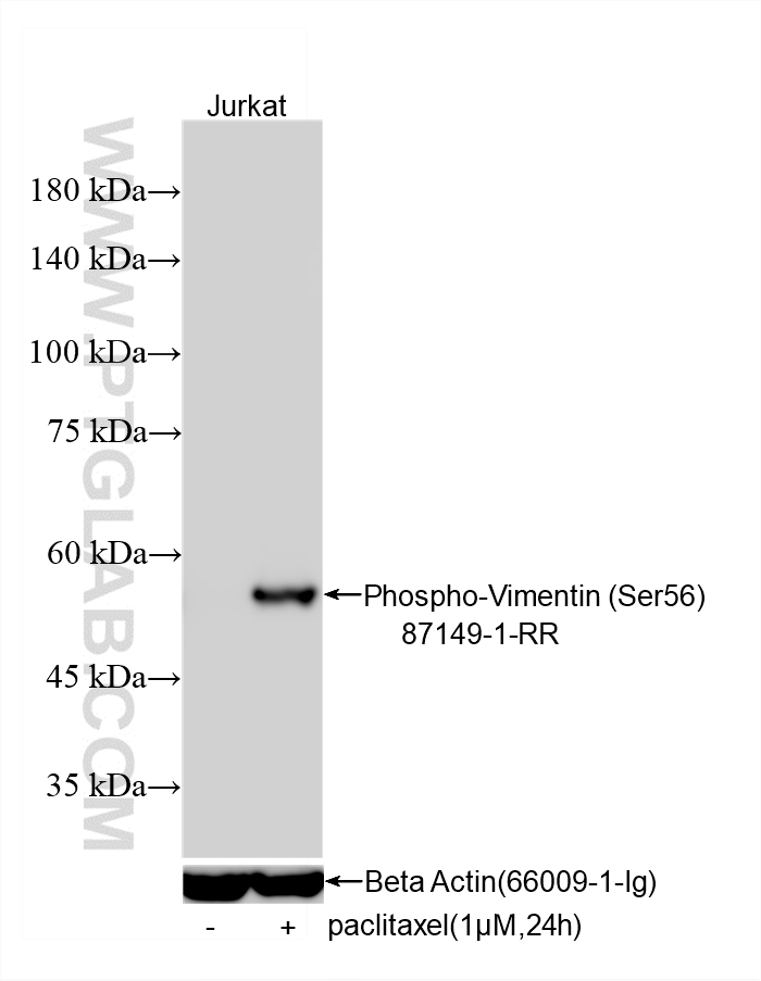Western Blot (WB) analysis of various lysates using Phospho-Vimentin (Ser56) Recombinant monoclonal an (87149-1-RR)