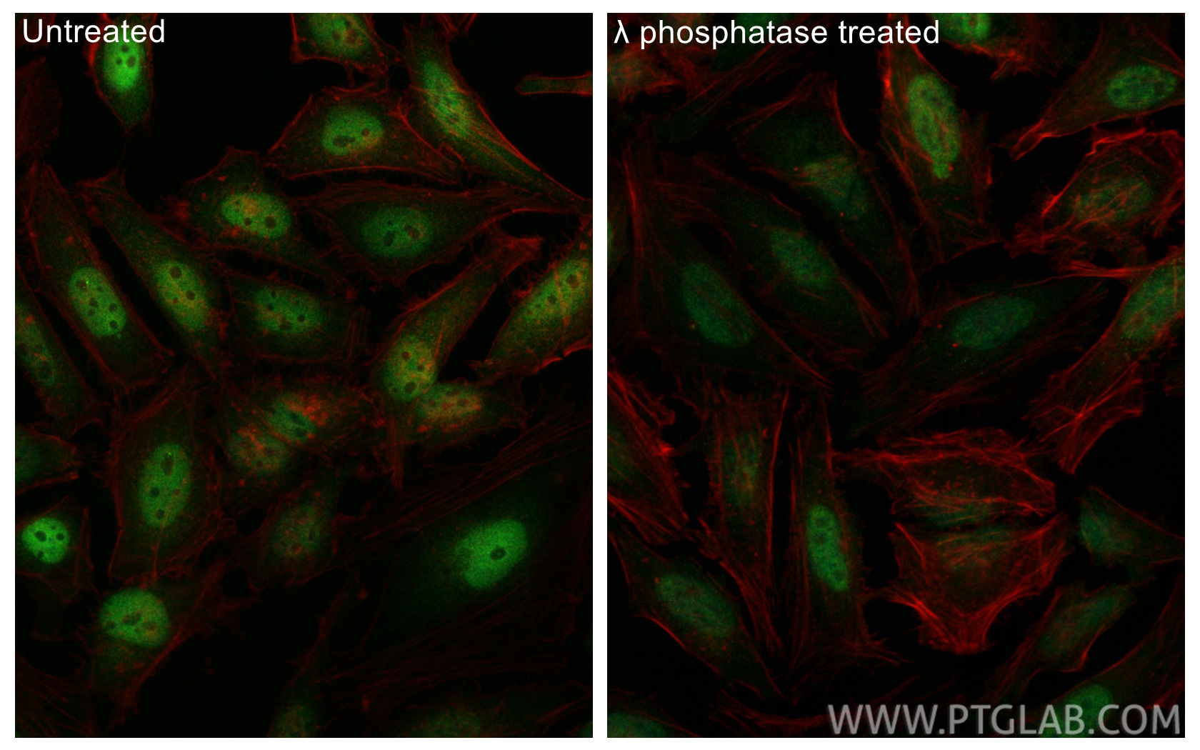 Immunofluorescence (IF) / fluorescent staining of HeLa cells using Phospho-c-MYC (Ser62) Polyclonal antibody (28915-1-AP)
