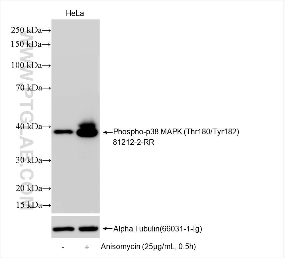 Western Blot (WB) analysis of various lysates using Phospho-p38 MAPK (Thr180/Tyr182) Recombinant antib (81212-2-RR)