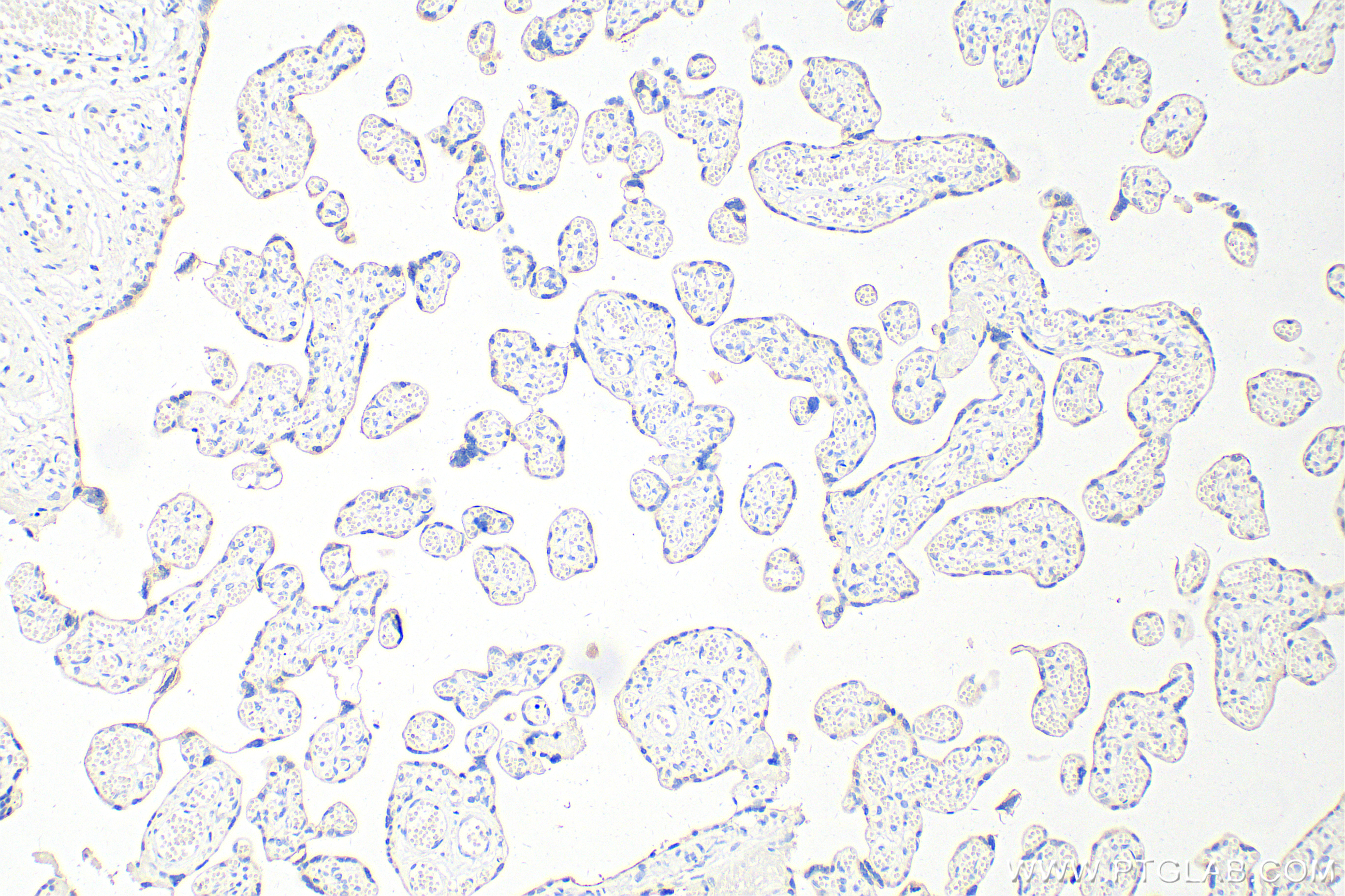 Immunohistochemistry (IHC) staining of human placenta tissue using Placental lactogen Monoclonal antibody (66728-1-Ig)