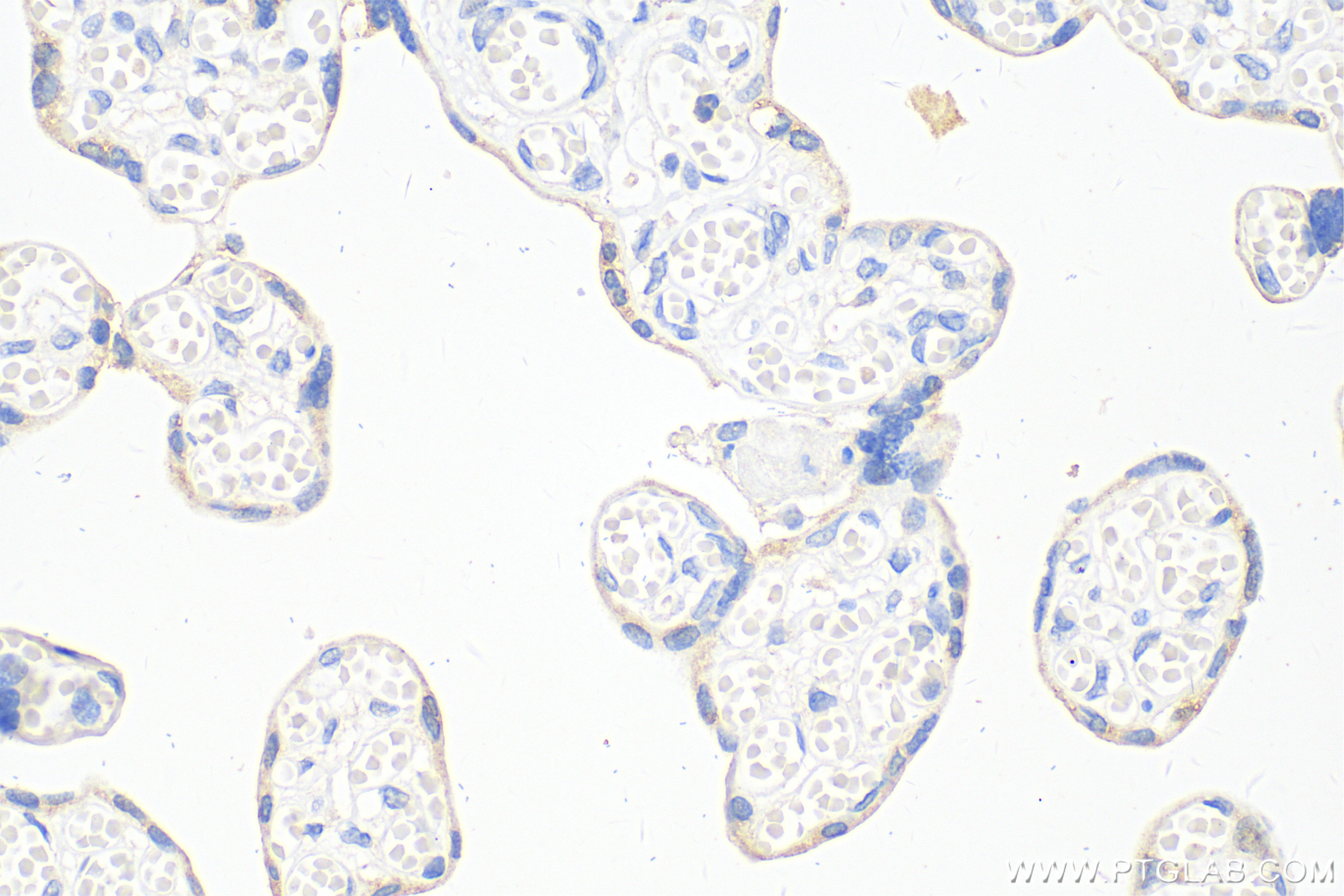 Immunohistochemistry (IHC) staining of human placenta tissue using Placental lactogen Monoclonal antibody (66728-1-Ig)