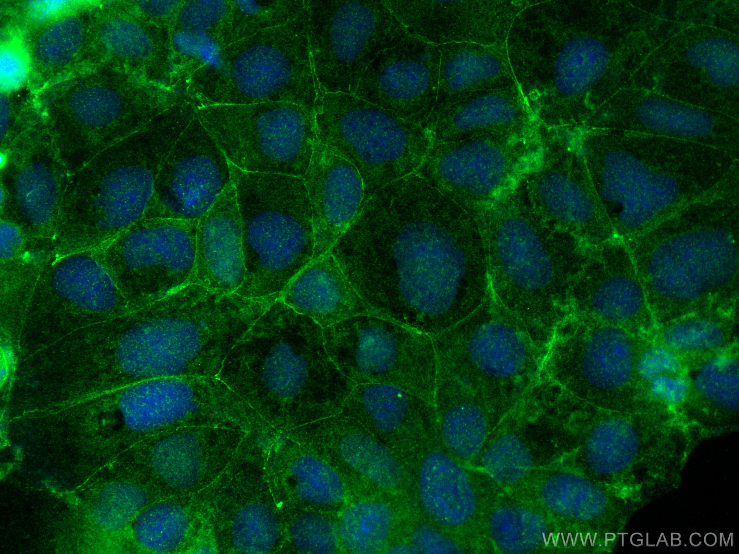 Immunofluorescence (IF) / fluorescent staining of Caco-2 cells using Plakophilin 2 Polyclonal antibody (26479-1-AP)