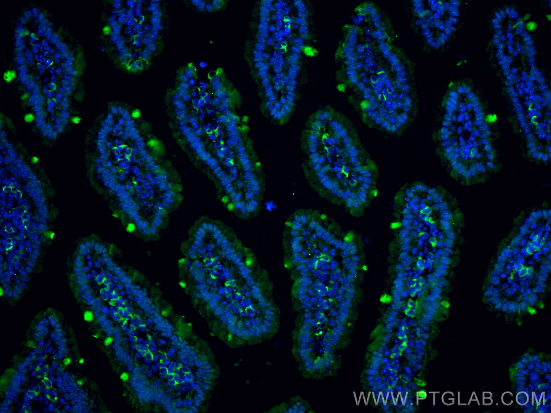 Immunofluorescence (IF) / fluorescent staining of mouse small intestine tissue using Podoplanin Monoclonal antibody (67432-1-Ig)