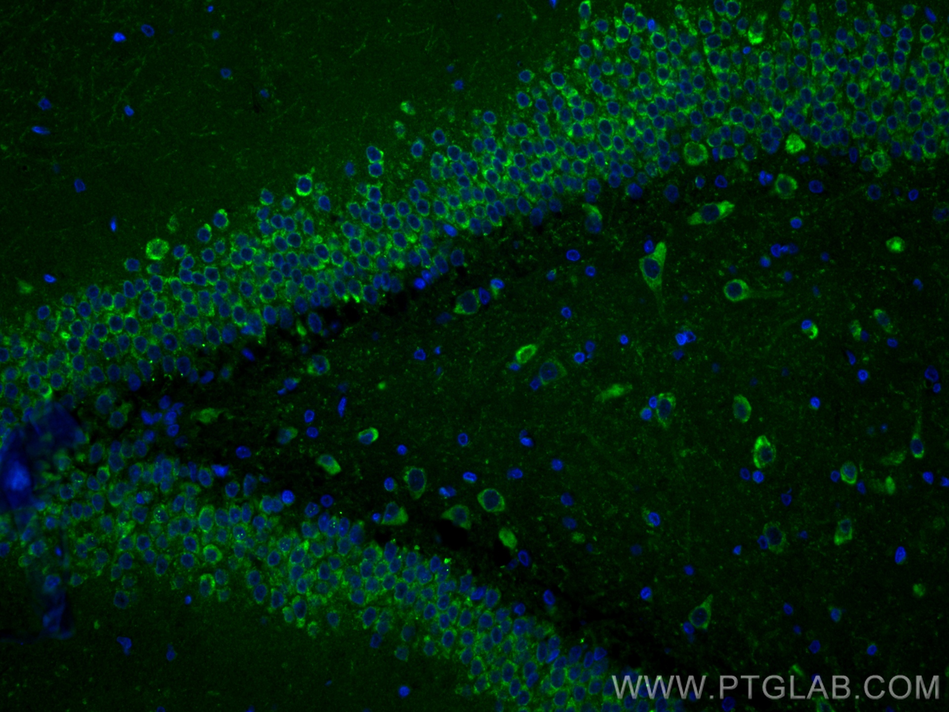 Immunofluorescence (IF) / fluorescent staining of rat brain tissue using Presenilin-1-Specific Recombinant antibody (83618-3-RR)