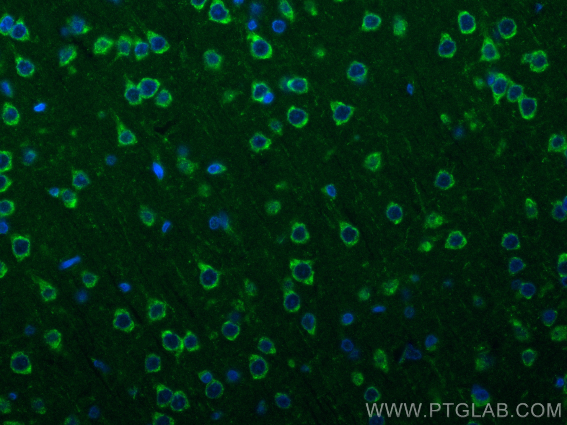 Immunofluorescence (IF) / fluorescent staining of rat brain tissue using Presenilin-1-Specific Recombinant antibody (83618-3-RR)