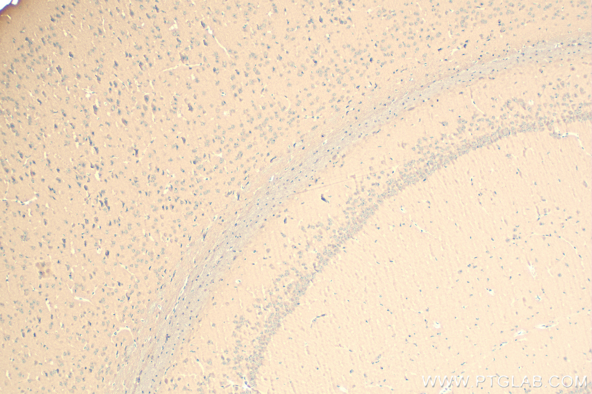 Immunohistochemistry (IHC) staining of mouse brain tissue using Presenilin-1-Specific Recombinant antibody (83618-3-RR)