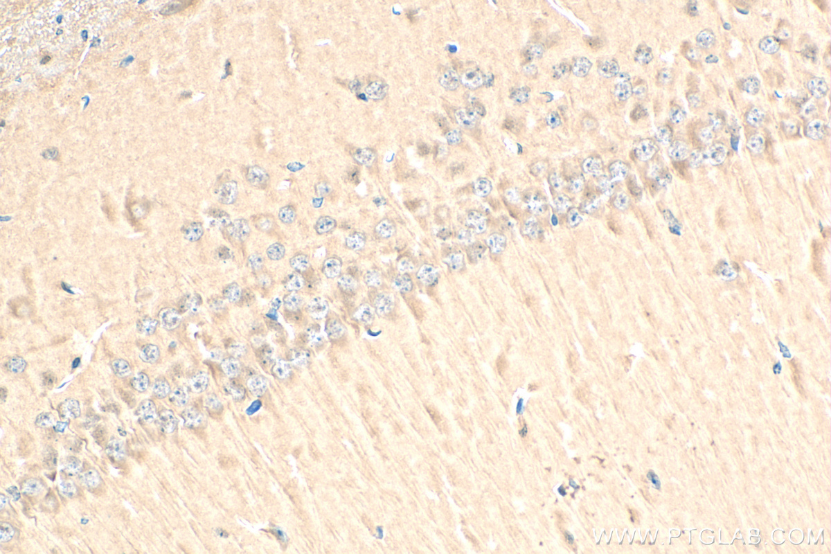 Immunohistochemistry (IHC) staining of mouse brain tissue using Presenilin-1-Specific Recombinant antibody (83618-3-RR)