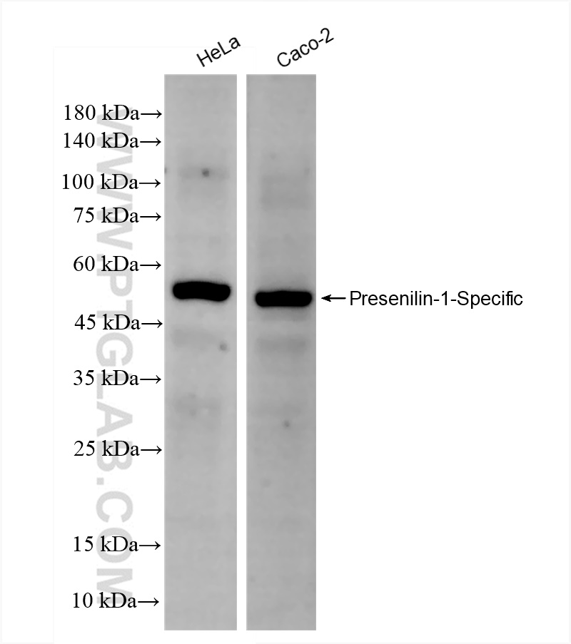 Western Blot (WB) analysis of various lysates using Presenilin-1-Specific Recombinant antibody (83618-3-RR)