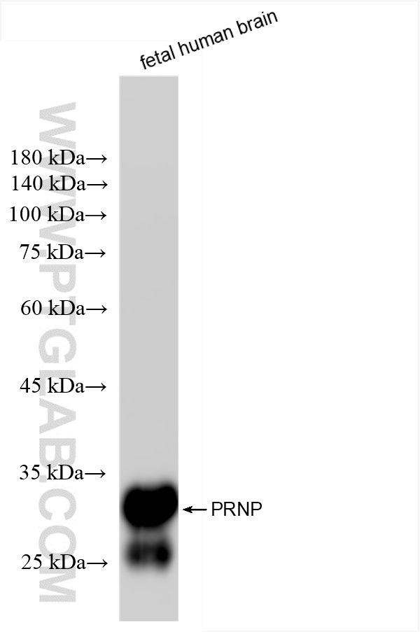 Western Blot (WB) analysis of fetal human brain tissue using Prion protein PrP/CD230 Recombinant antibody (85611-4-RR)