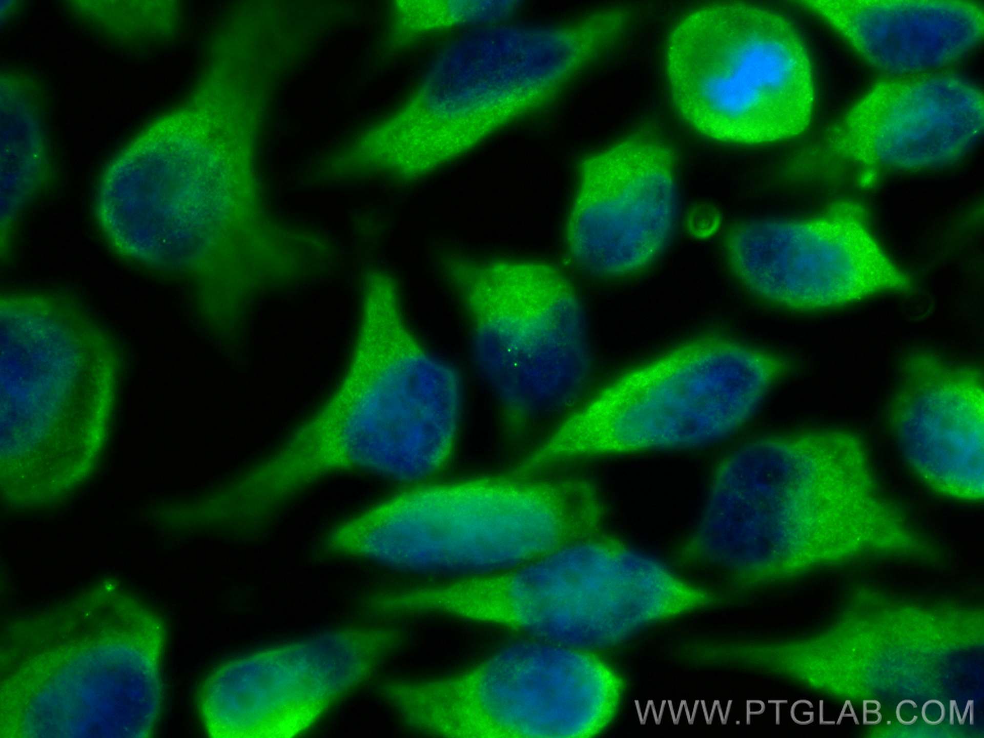 Immunofluorescence (IF) / fluorescent staining of HeLa cells using ProSAPiP1 Polyclonal antibody (24936-1-AP)