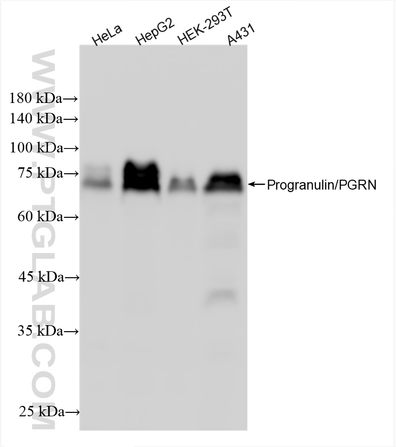 Western Blot (WB) analysis of various lysates using Progranulin/PGRN Recombinant antibody (86118-2-RR)
