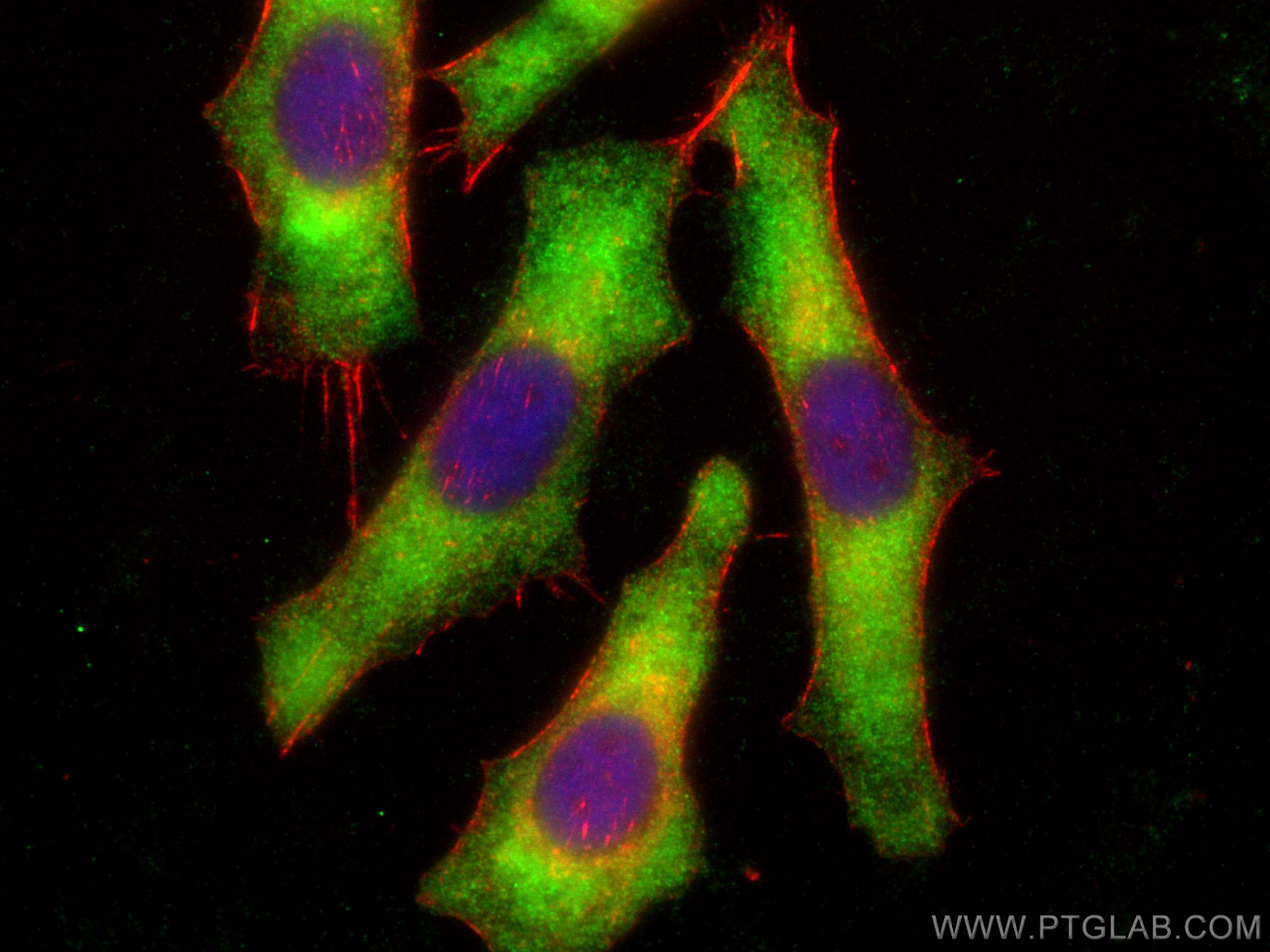 Immunofluorescence (IF) / fluorescent staining of PC-3 cells using GlnRS Polyclonal antibody (12645-1-AP)