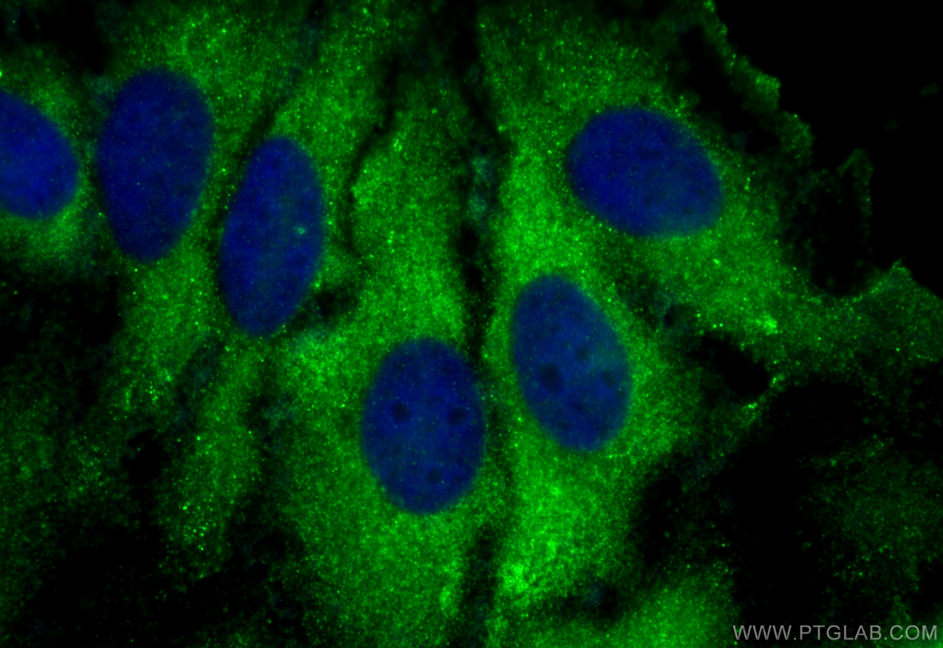 Immunofluorescence (IF) / fluorescent staining of HeLa cells using GlnRS Polyclonal antibody (12645-1-AP)