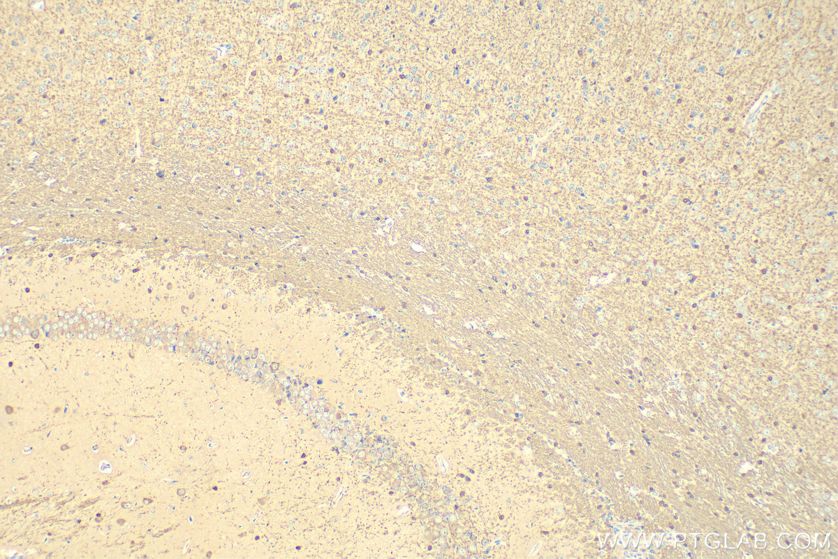 Immunohistochemistry (IHC) staining of mouse brain tissue using QDPR Polyclonal antibody (14908-1-AP)