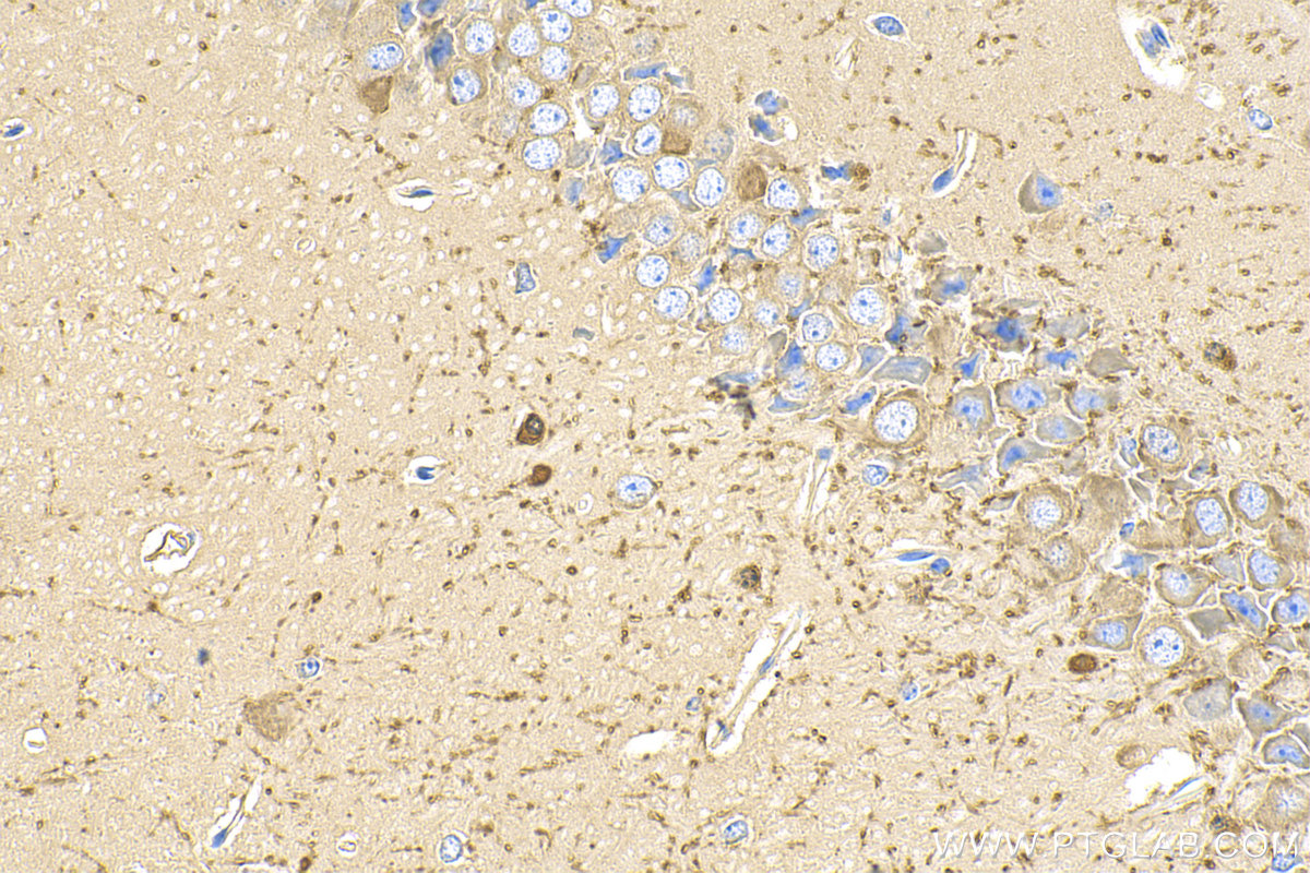 Immunohistochemistry (IHC) staining of mouse brain tissue using QDPR Polyclonal antibody (14908-1-AP)