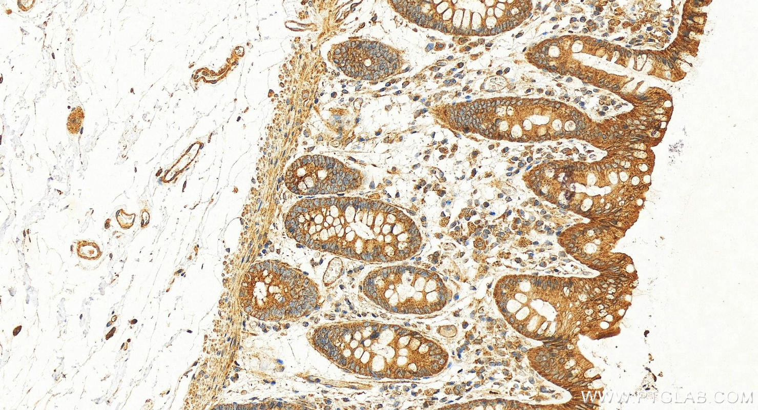 Immunohistochemistry (IHC) staining of human colon tissue using RAB10 Polyclonal antibody (27094-1-AP)