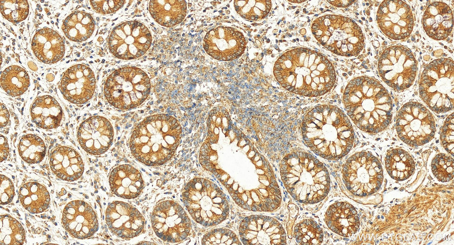 Immunohistochemistry (IHC) staining of human colon tissue using RAB10 Polyclonal antibody (27094-1-AP)