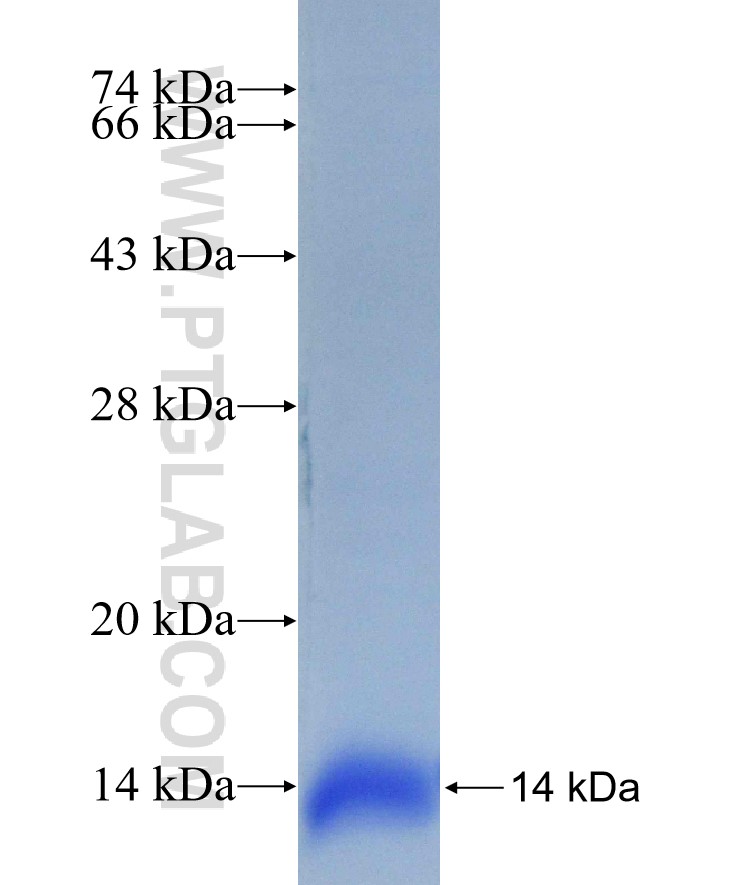 RAB10 fusion protein Ag25863 SDS-PAGE