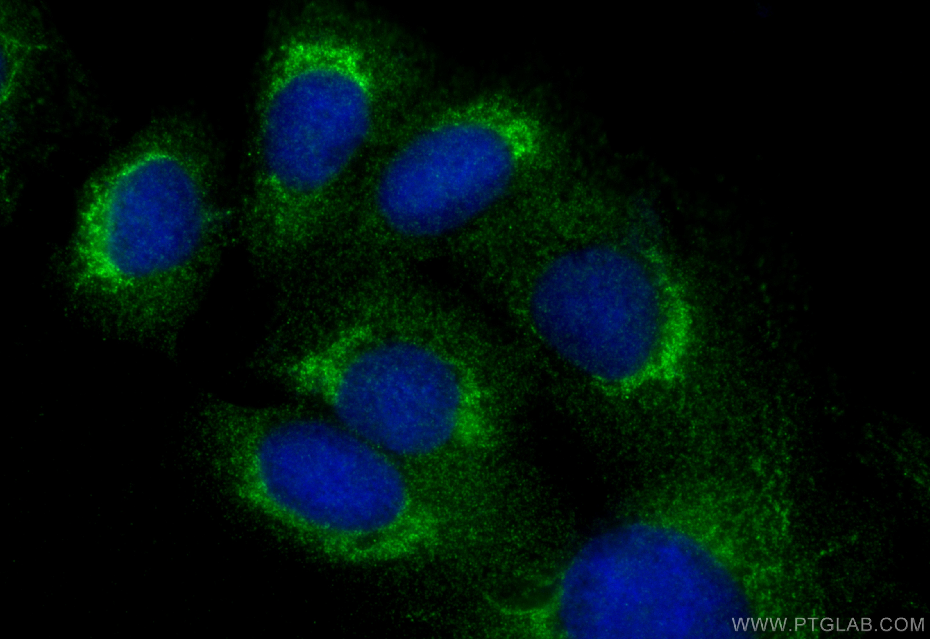 Immunofluorescence (IF) / fluorescent staining of U2OS cells using RAB11A/B Polyclonal antibody (15903-1-AP)