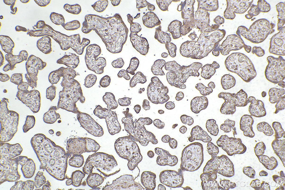 Immunohistochemistry (IHC) staining of human placenta tissue using RAB11A/B Polyclonal antibody (15903-1-AP)