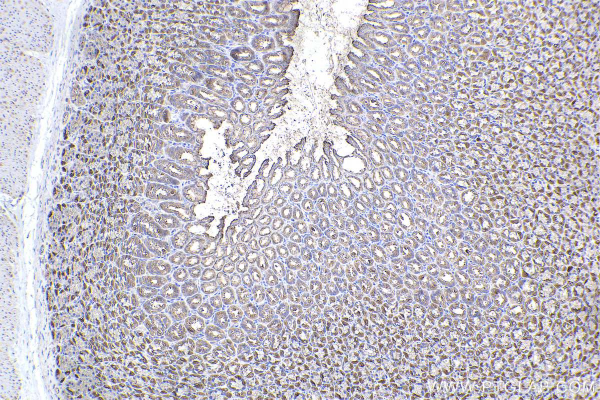 Immunohistochemistry (IHC) staining of rat stomach tissue using RAB11A/B Polyclonal antibody (15903-1-AP)