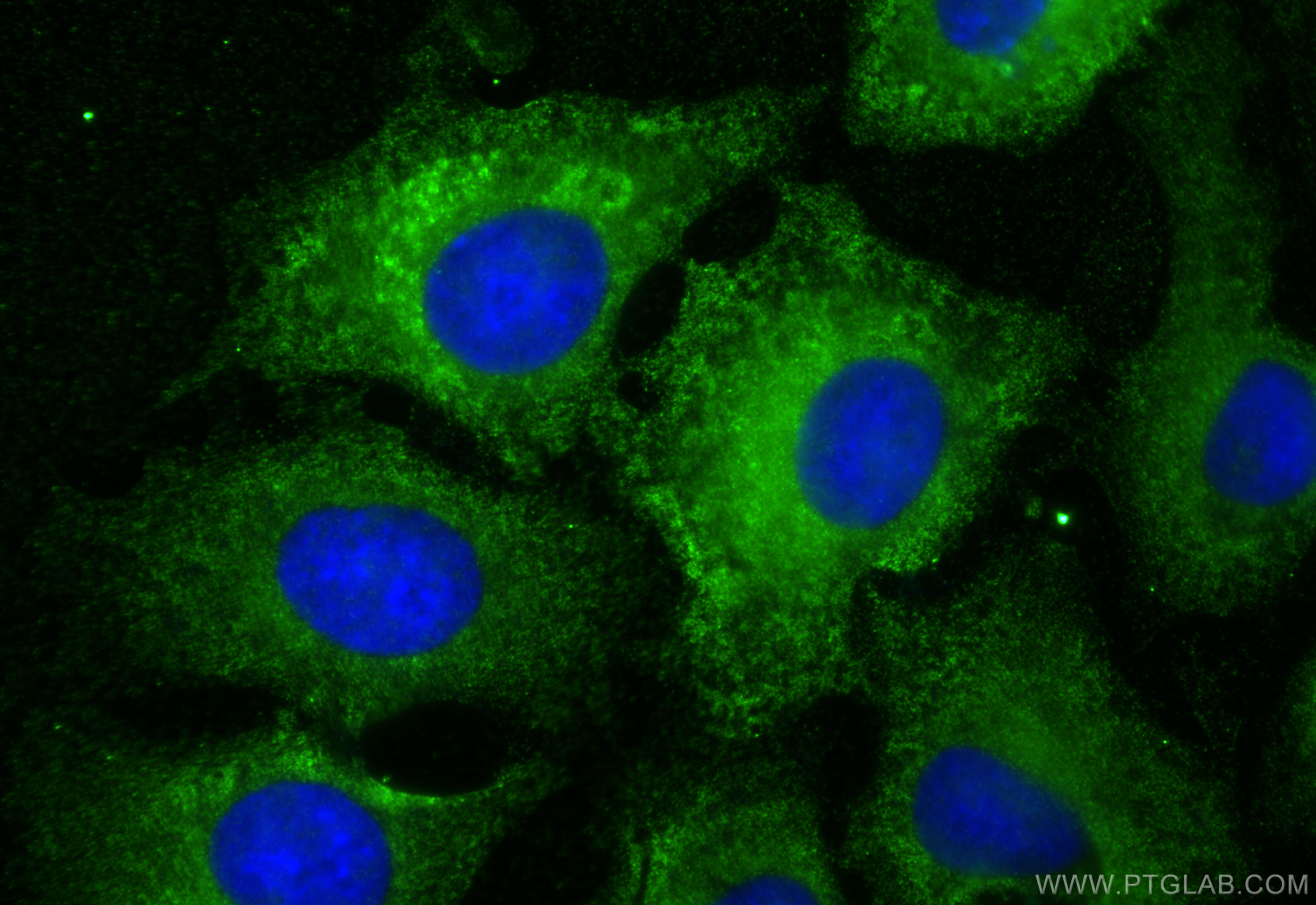 Immunofluorescence (IF) / fluorescent staining of A549 cells using RAB11A Monoclonal antibody (67902-1-Ig)