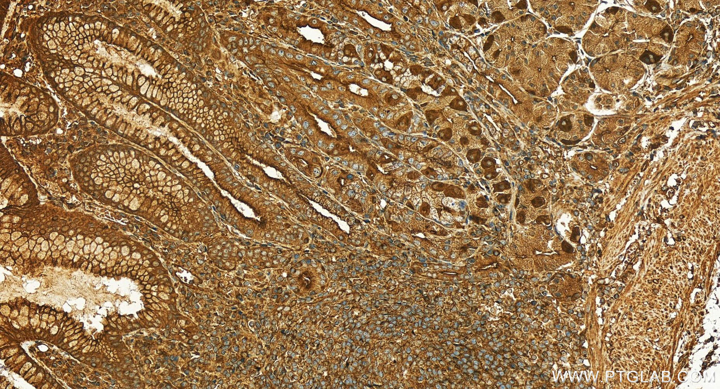 Immunohistochemistry (IHC) staining of human stomach tissue using RAB11B Polyclonal antibody (28498-1-AP)