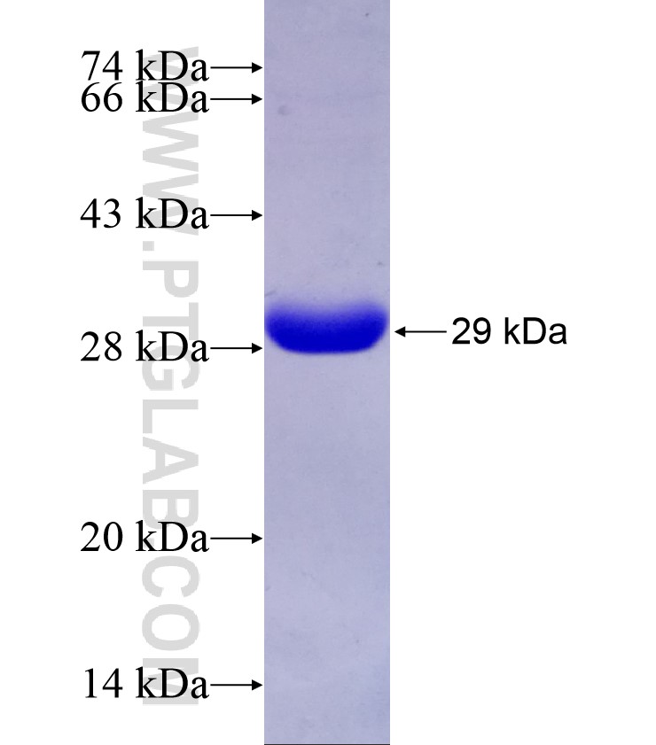 RAB11B fusion protein Ag28992 SDS-PAGE