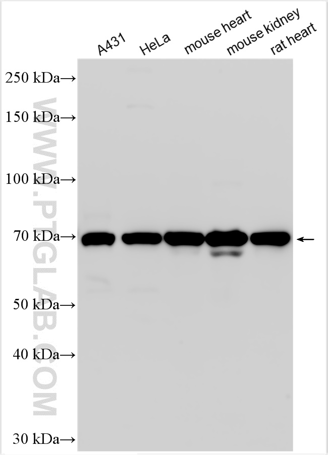 Western Blot (WB) analysis of various lysates using RAB11FIP5 Polyclonal antibody (14594-1-AP)