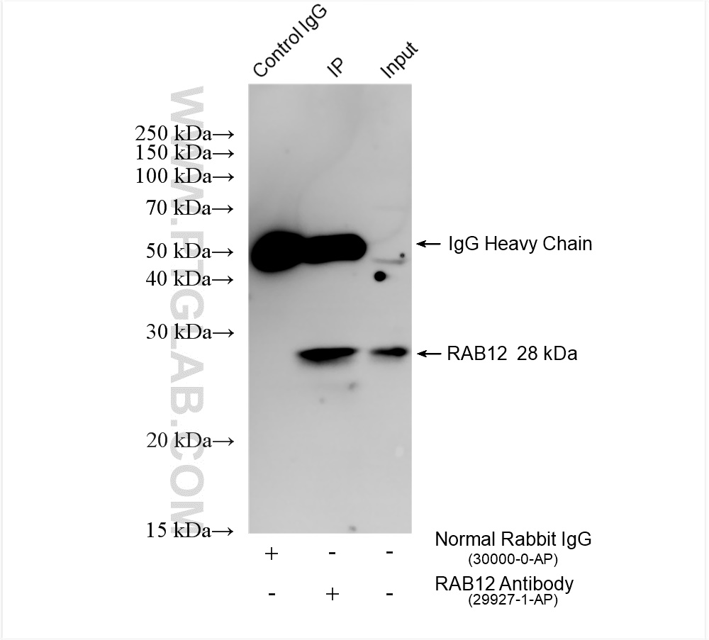 Immunoprecipitation (IP) experiment of mouse brain tissue using RAB12 Polyclonal antibody (29927-1-AP)